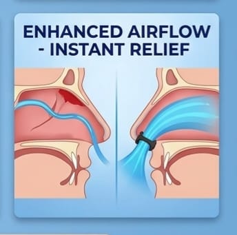 Nasal Strips For breathing (Pack Of 4)